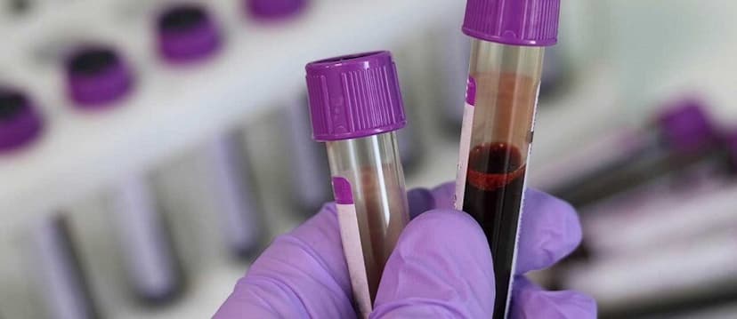 Vitamin b12 level test purpose procedure and results