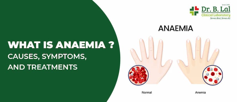 What is Anaemia? Causes, Symptoms, and Treatments