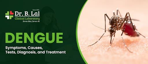 Dengue: Symptoms, Causes, Tests, Diagnosis and Treatment