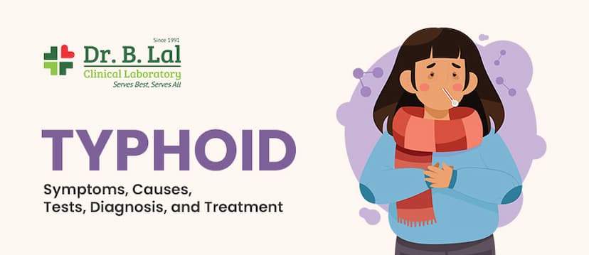 Typhoid: Symptoms, Causes, Diagnosis, Tests and Treatment