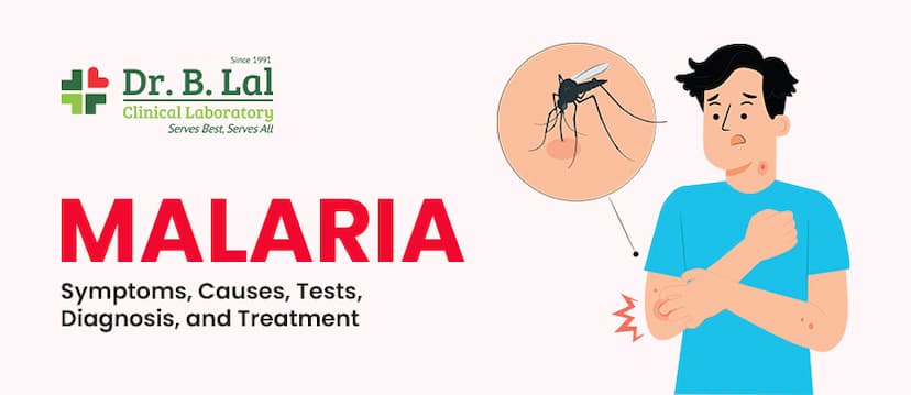 Malaria: Symptoms, Causes, Tests, Diagnosis, and Treatment