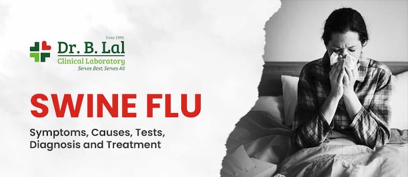 Swine Flu: Symptoms, Causes, Tests, Diagnosis, and Treatment