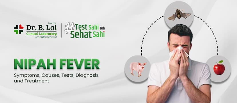 Nipah Virus: Symptoms, Transmission,   Diagnosis and Treatment