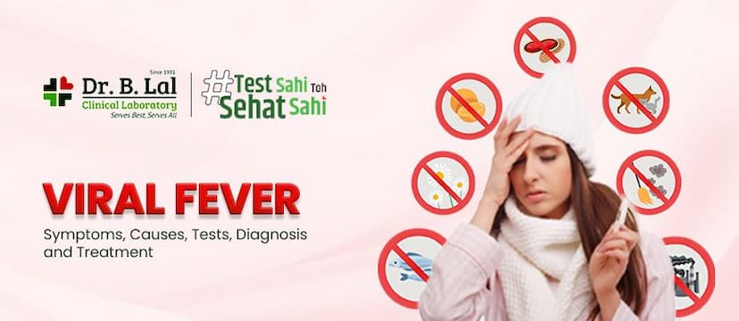 Viral Fever: Symptoms, Causes, and Treatment