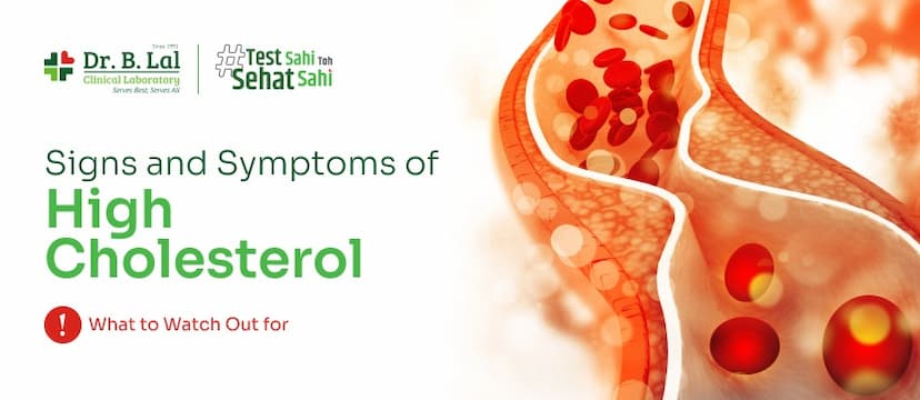 Signs and Symptoms of High Cholesterol: What to Watch Out For