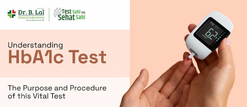 Understanding HbA1c Test: The Purpose and Procedure of this Vital Test