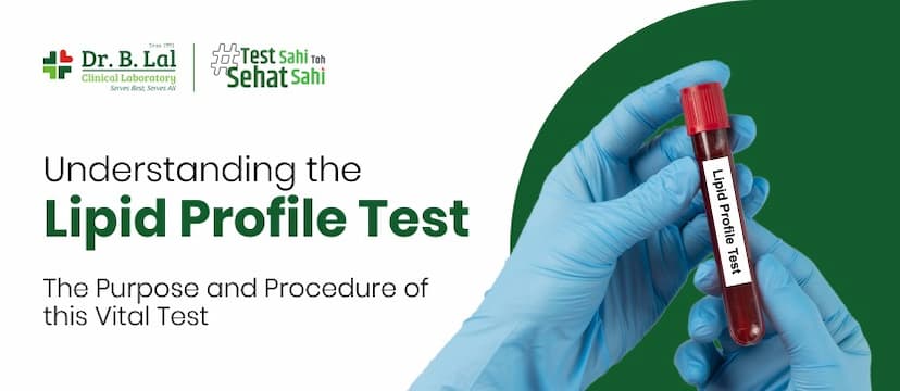 Understanding the Lipid Profile Test: The Purpose and Procedure of this Vital Test